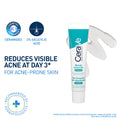 CeraVe Blemish Control Gel with 2% Salicylic Acid, AHA & Niacinamide for Acne Spot Treatment