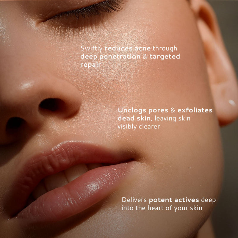 Lumineve 2% Salicylic Acid Face Serum for Active Acne & Pores with Advanced NightRenew Complex