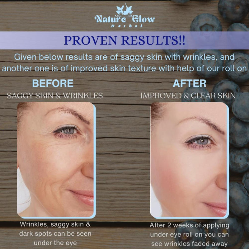 Nature Glow Herbal Under Eye Blueberry Roll On