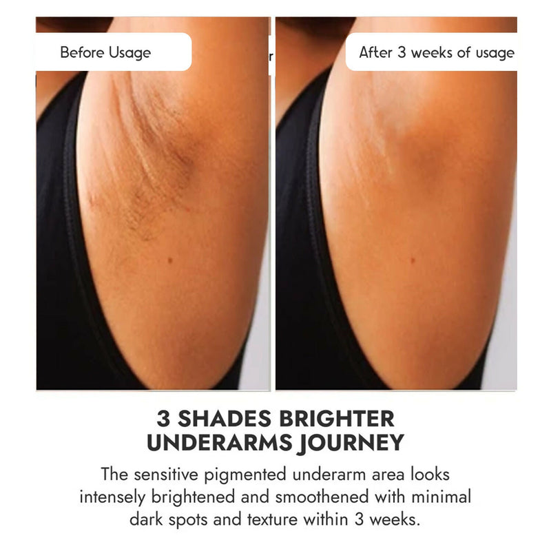 Cos-IQ Brightening Underarm Roll On Serum For Men, With Bioecolea, Mandelic Acid and Bio White