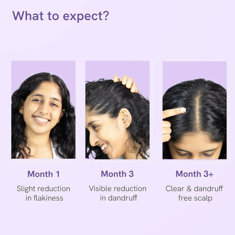 BeBodywise Anti Dandruff Hair Serum - Limited Time Offer