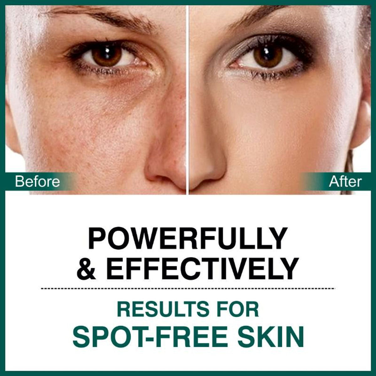 She Essentials Dark Spot Corrector Cream, Niacinamide & Vitamin E Oil