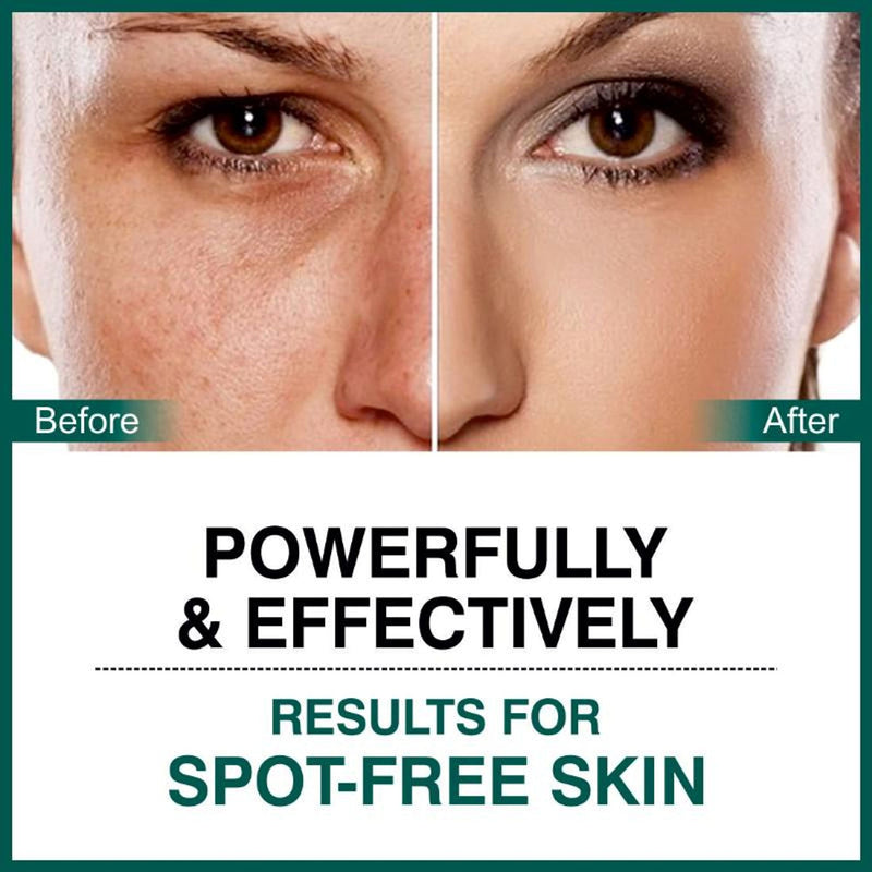 She Essentials Dark Spot Corrector Cream, Niacinamide & Vitamin E Oil