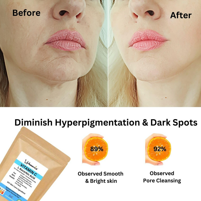 Urbaano Herbal L-Ascorbic Acid (Vitamin C Powder)