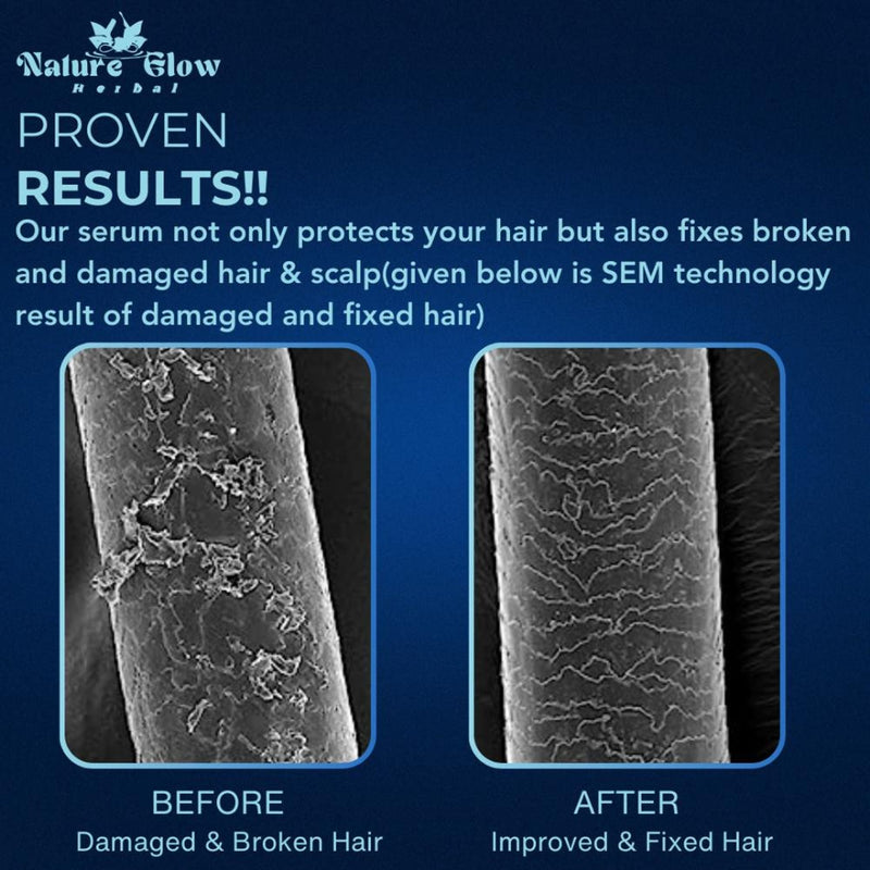 Nature Glow Herbal Total Repair 5 Hair Serum