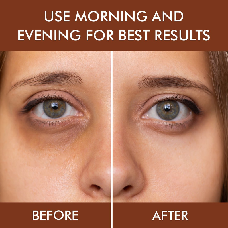 Nuerma Science Under Eye Gel Massage Roll-On to Reduce Dark Circles, Soothes Puffy Eyes