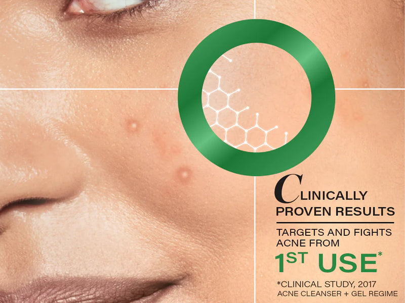 Novology Acne Rescue Spot Corrector Gel