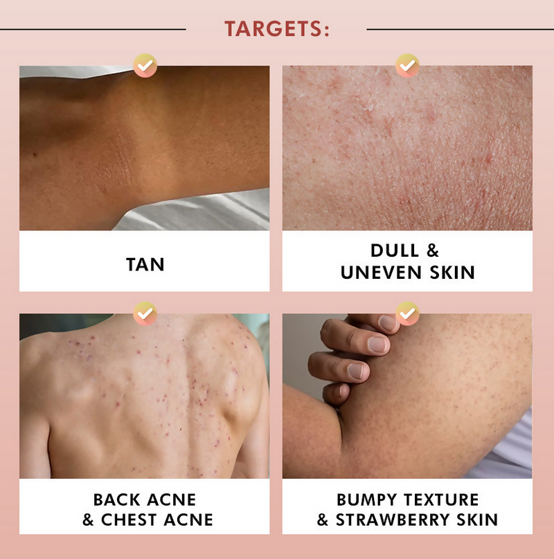 mCaffeine Brighten, De-Tan & Acne-Free Body Wash