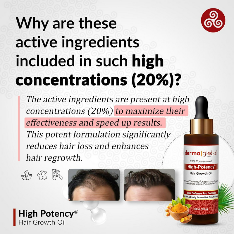 Derma Global High Potency Hair Growth Oil