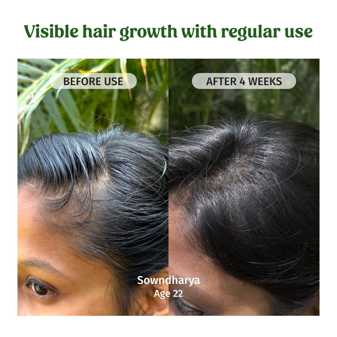 Hair Regrowth Oil