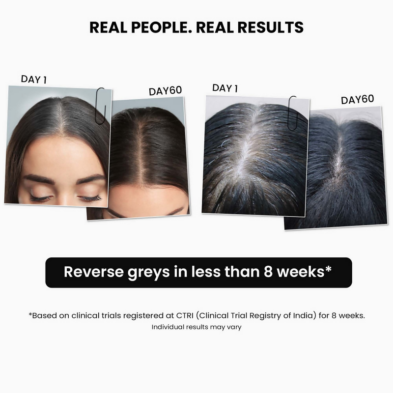 ThriveCo AntiGreying Hair Prime Serum - Reverses Premature Greying Colour