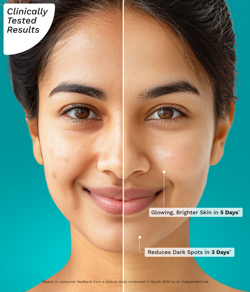 Pilgrim 10% Vitamin C Face Serum For Daily Brightness 5% Niacinamide