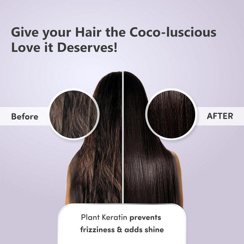 Mylo Care Anti Hair Fall Conditioner