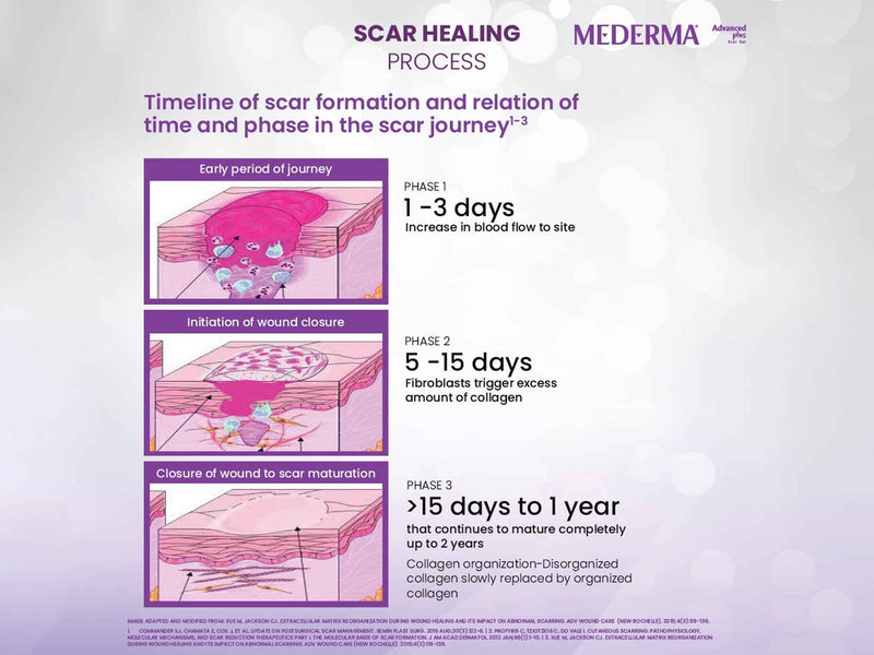 Mederma Advanced Plus Scar Gel
