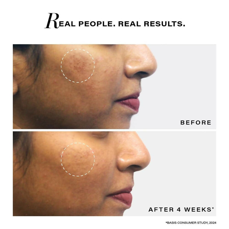 Novology Pigmentation Reduction Serum For Dark Spots