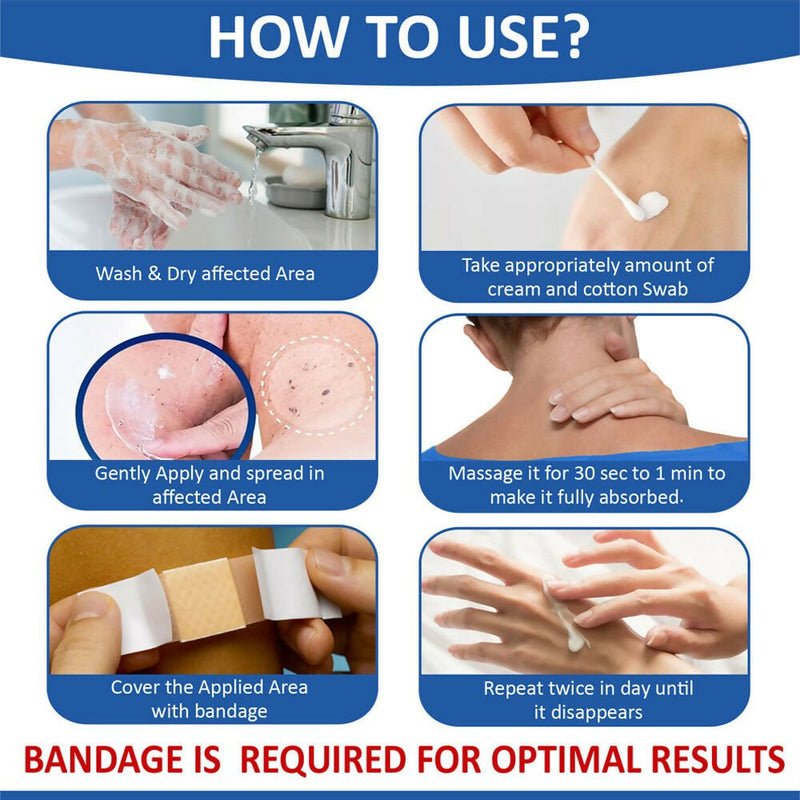 7 Days Natural Wart Remover Cream with AHA- BHA