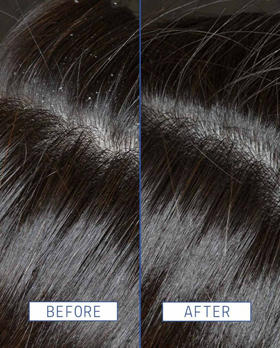 Aavrani Scalp Rescue Serum