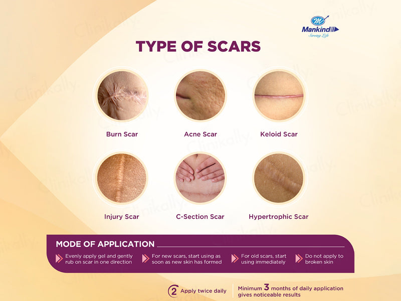 ScarEnd Silicone Gel