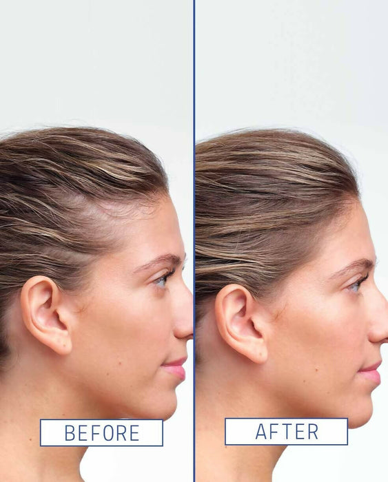 Aavrani Hair Density Boosting Treatment (Serum)