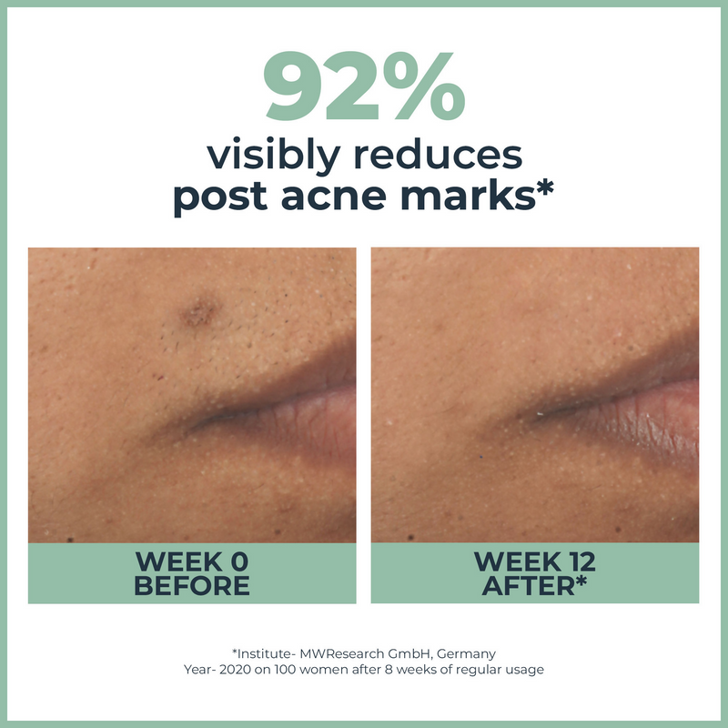 Eucerin DermoPurifyer Oil Control Face Serum