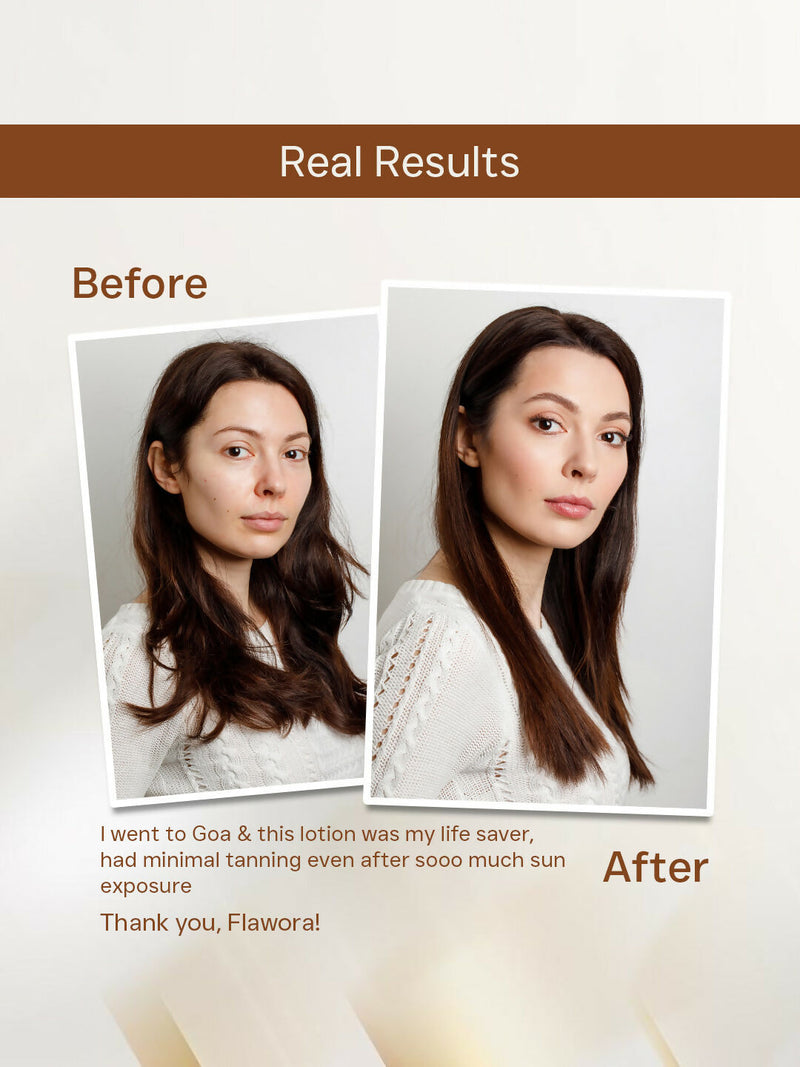 Flawora D-Tan Lotion, Anti Acne Serum And Gold Face Serum Combo