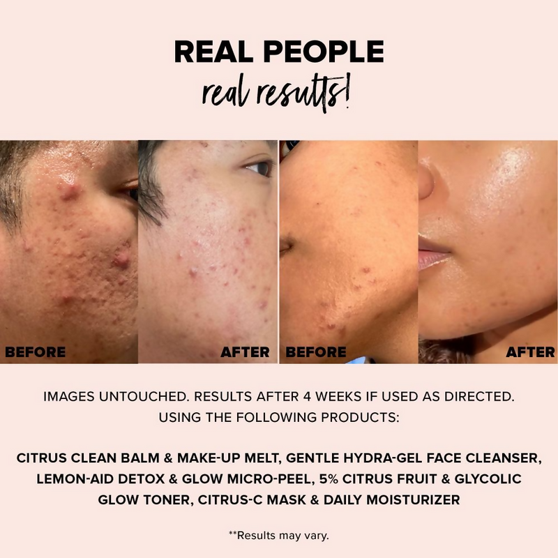 Nudestix Nudeskin Gentle Hydra-Gel Face Cleanser