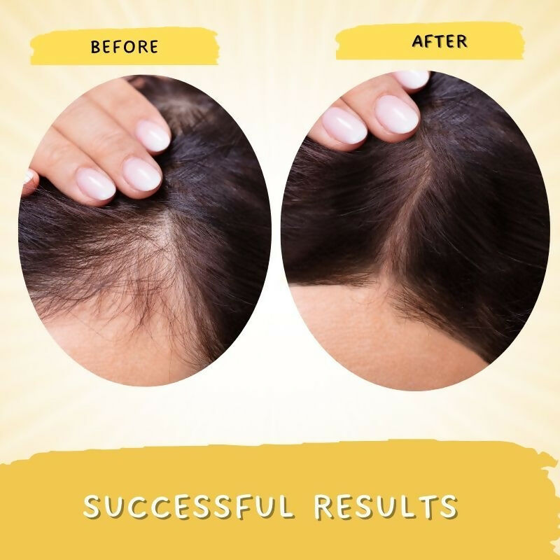 Mystiq Living Rosemary Hair Growth Serum