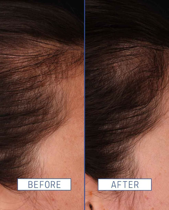 Aavrani Hair Density Boosting Treatment (Serum)