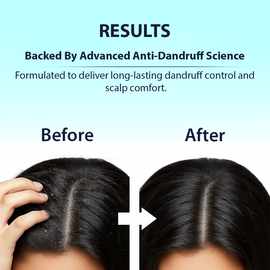 Dermistry Anti-Dandruff Control Hair Serum