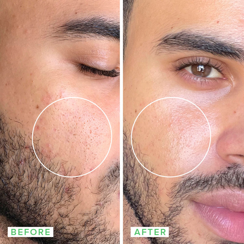 Farmacy Beauty Deep Sweep 2% BHA Pore Cleaning Toner With Salicylic Acid & Moringa Water