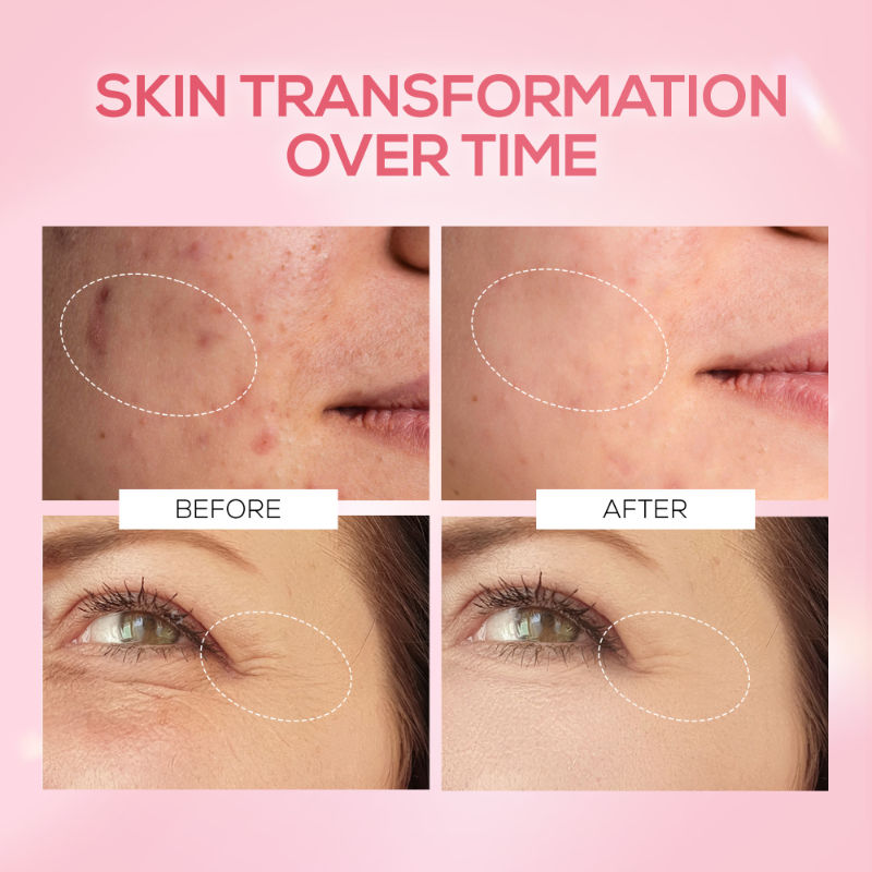 Renee Cosmetics Pink Therapy PDRN Pink Peptide Serum For Radiant Skin, Hydrating, Hyaluronic Acid Infused