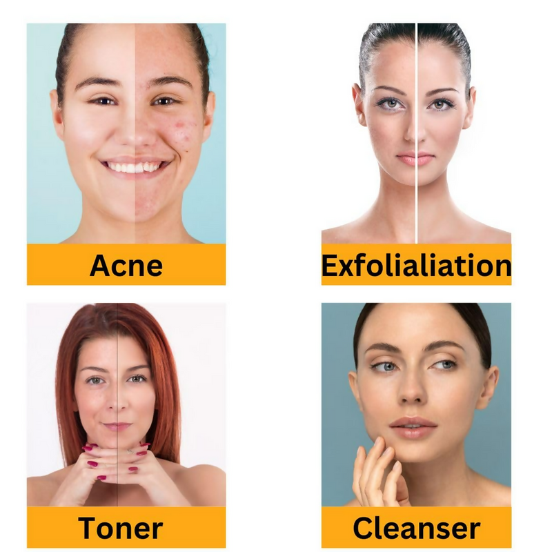 Urbaano Herbal Glycolic Acid 70%, Liquid for Cleansers