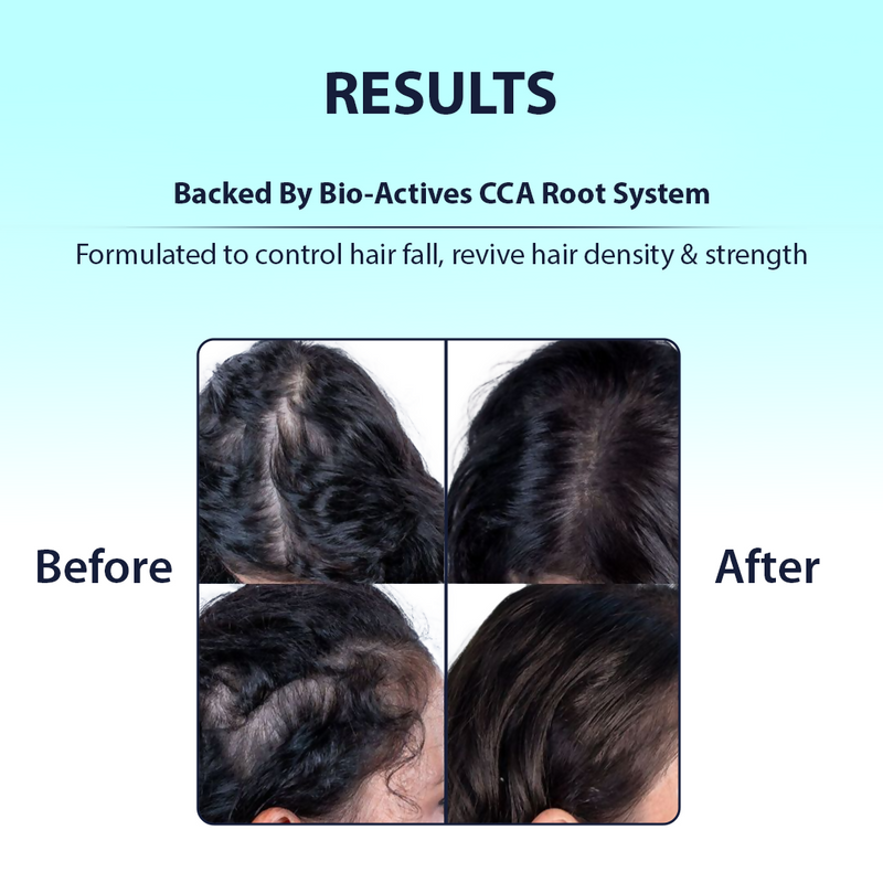 Dermistry Caffeine Collagen Protein Anti-Hair Fall Control Mask