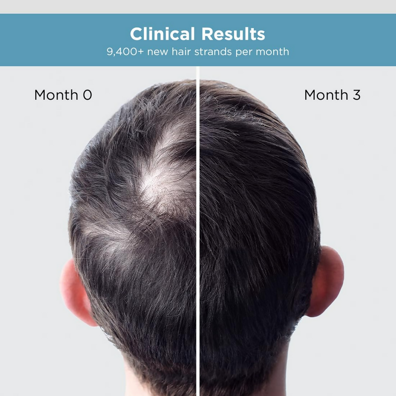 The Man Company Hair Growth Serum For Man