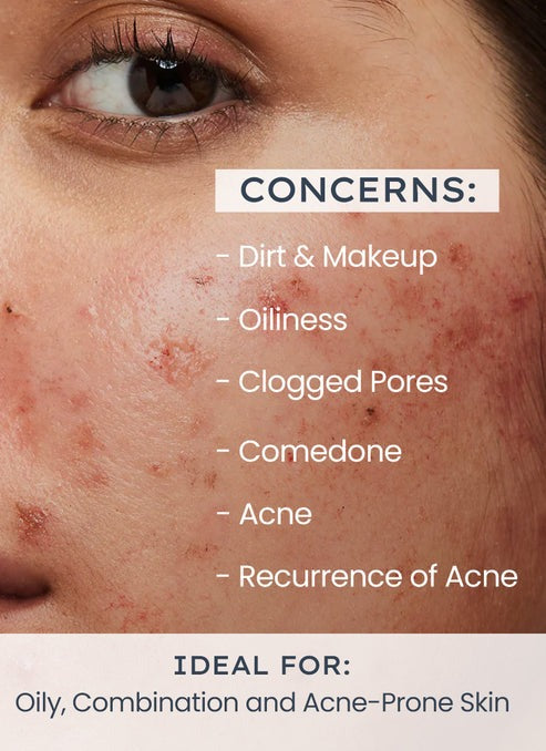 Hyphen By Kriti Sanon Oil Control Daily Cleanser, 2% AHA + BHA Salicylic Acid Face Wash, Deep Cleanses & Removes Dirt, For Men & Women