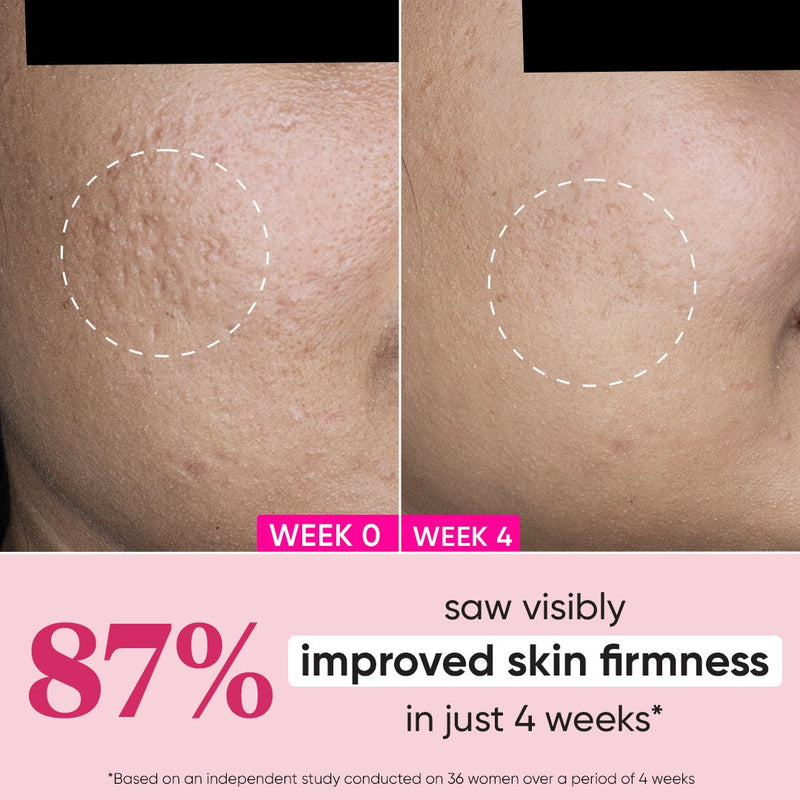 Dot & Key Pomegranate Miracle Vitamin E Revitalizing Moisturizer