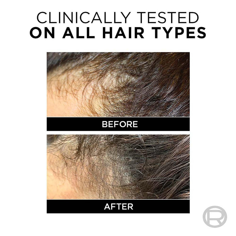 L'Oreal Paris Fall Resist 3X Anti-Hairfall Shampoo