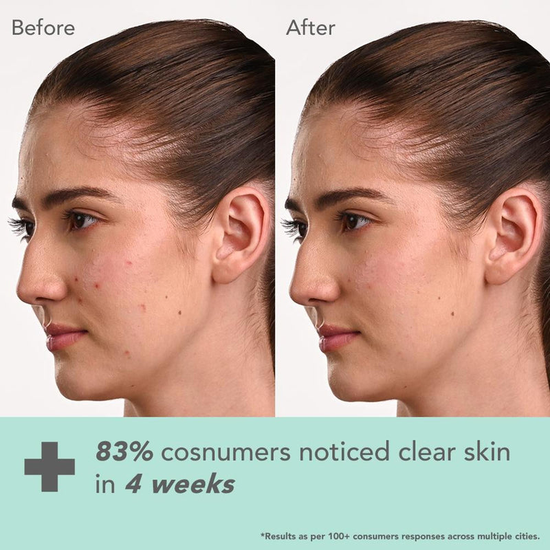 Lotus DermaBotanics Kojic Acid + Multi Berry Ampoule Crème, pH5.5, For Sensitive Skin