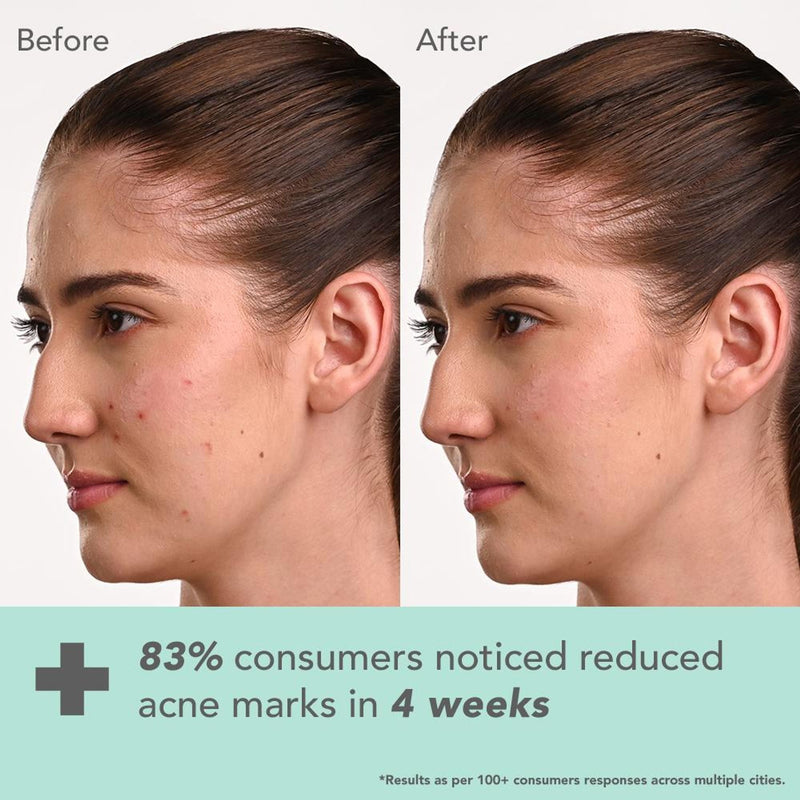 Lotus Herbals Derma Botanics Hi-Dose Serum Kojic Acid + Multi Berry, PH5.5 For Sensitive Skin