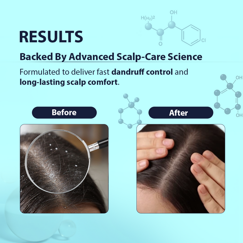 Dermistry Anti-Dandruff Control Hair Serum & Shampoo