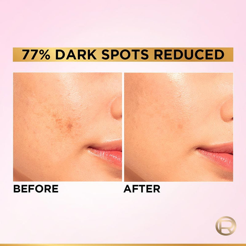 L'Oreal Paris Glycolic Bright 8% [Melasyl + Niacinamide] Face Serum For Brightening Dark Spots