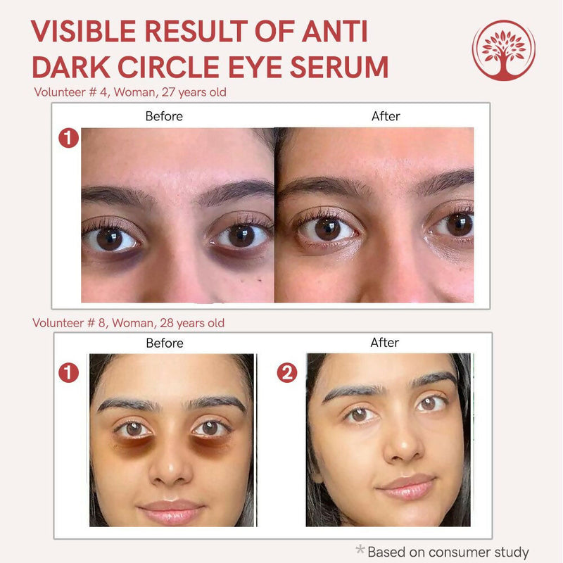 Ivory Natural Dark Circle Eye Serum For Dark Eye Circles, Under-Eye Patches, Swollen Eyes
