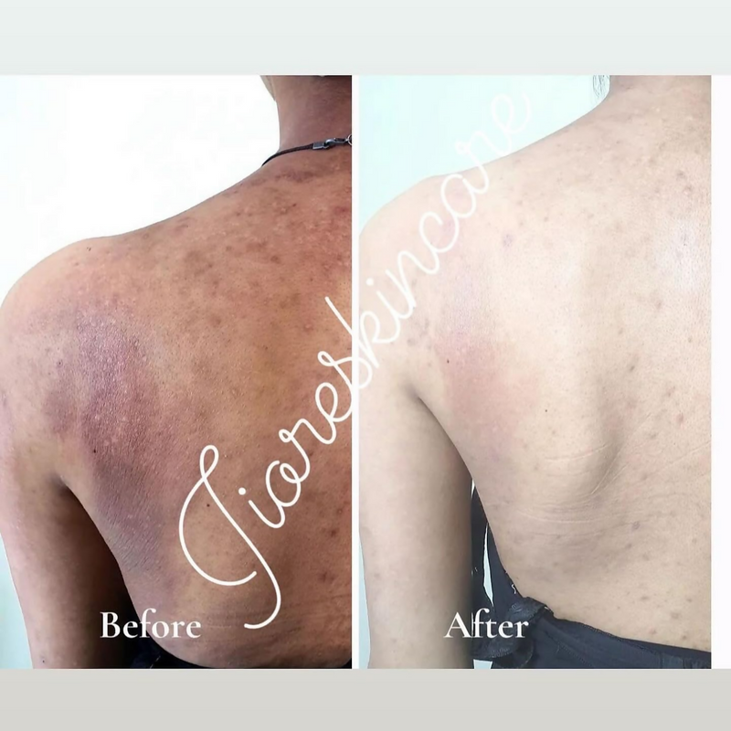 Pinkin Jiore skincare sinche Body Soap