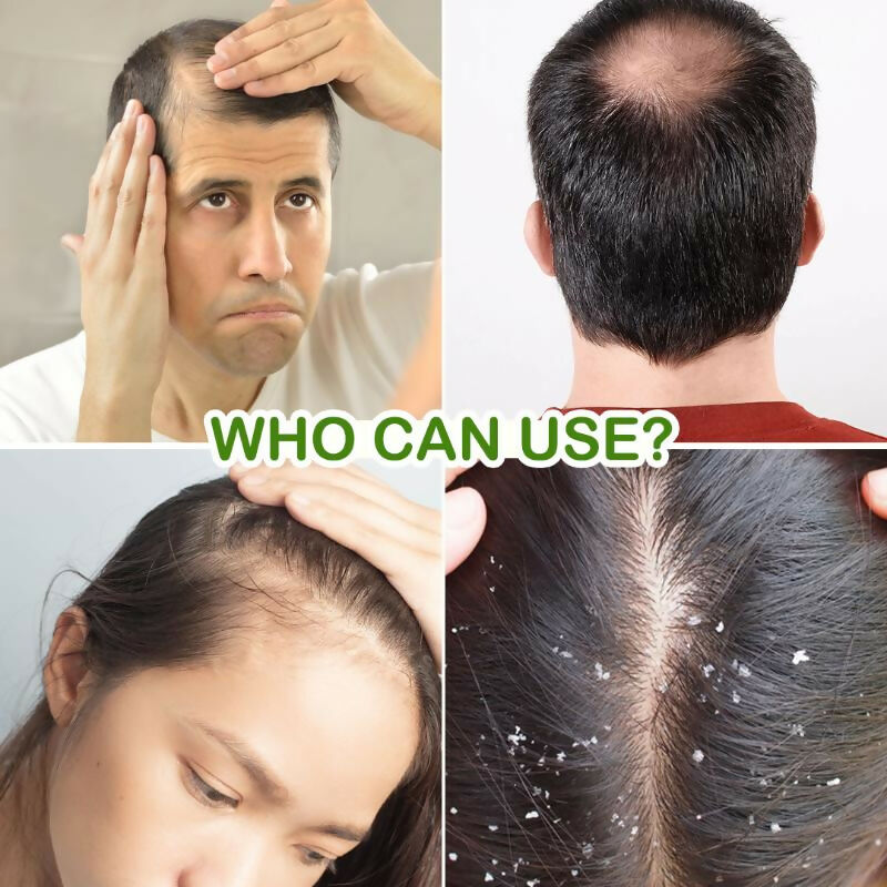 Jovees Herbal Rosemary Water Spray With Follicusan DP