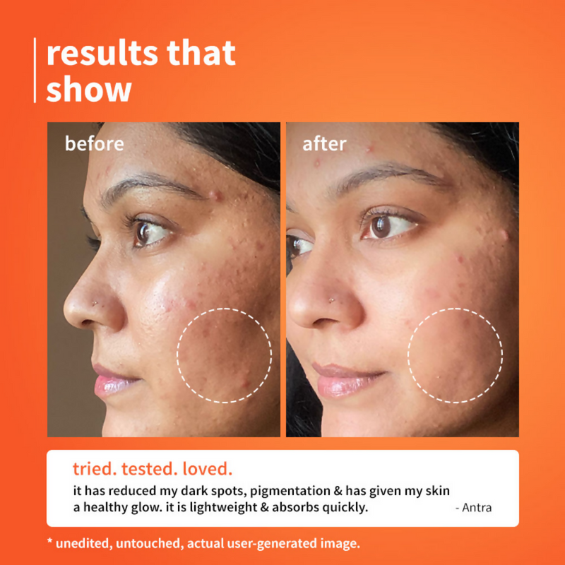 Plum 10% Vitamin C Barrier Boosting + Glow Serum with Calendula For Glowing Skin