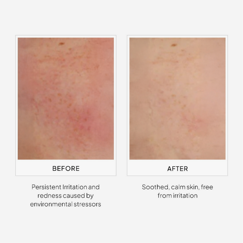 Miduty by Palak Notes EpiShield Day Serum