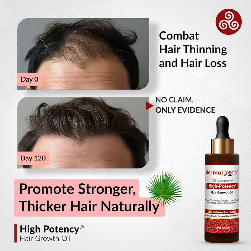 Derma Global High Potency Hair Growth Oil