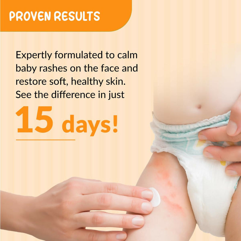 Fixderma Baby Hoopoe Diaper Rash Cream with Zinc Oxide & Panthenol