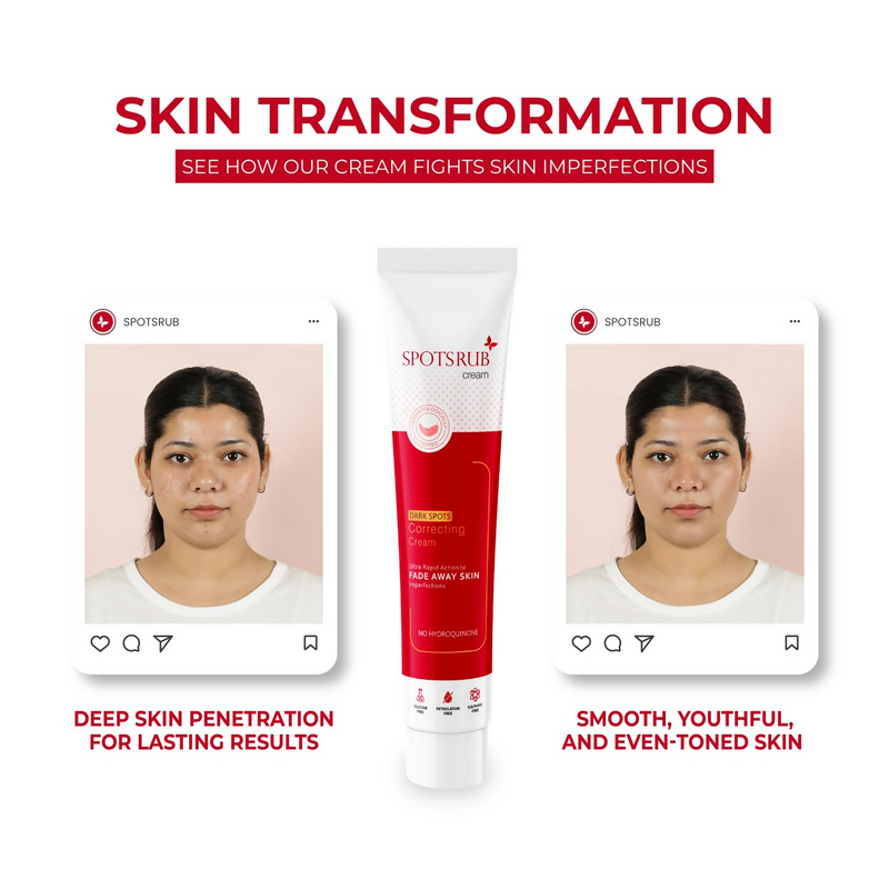 Leeford Spotsrub Face Cream For Women